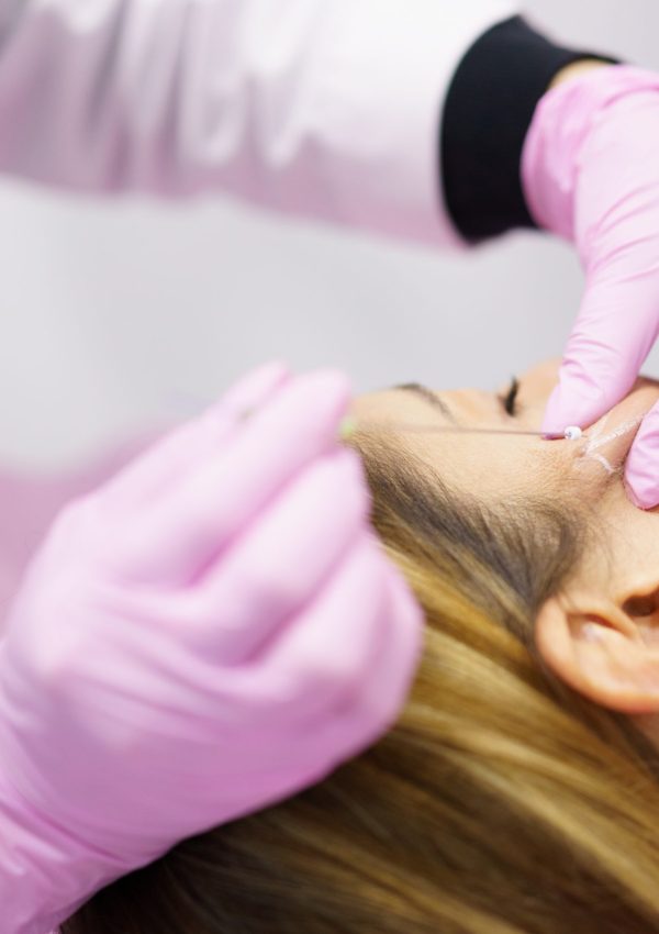 Doctor,Injecting,Pdo,Suture,Treatment,Threads,Into,The,Face,Of