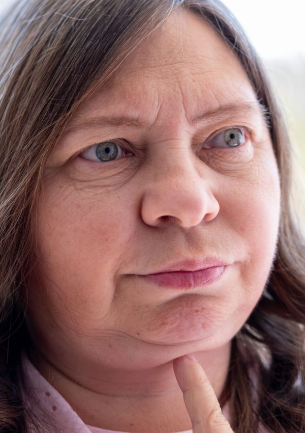 Part,Face,Mature,Woman,50,Years,Old,,Human,Fat,Neck,