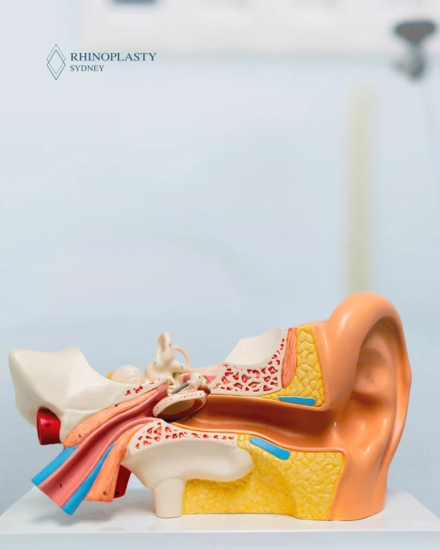 The ear and nose are more connected than most people realise.

This model shows how the nasal passages and the middle ear are linked through the Eustachian tube, which helps regulate pressure and drainage. When this pathway is not functioning well, it can lead to symptoms such as ear fullness, reduced hearing, or recurring infections.

Understanding this connection is an important part of assessing both nasal and ear conditions, especially when symptoms overlap.

Disclaimer: 

Any surgical or invasive procedure carries risks. See our dedicated Risks and Complications page for full details on general and procedure specific risks, recovery timelines, and outcome variations. Before proceeding, you should seek a second opinion from an appropriately qualified health practitioner.

Individual results, healing, recovery, and risks vary between patients. Before and after images on this page are authentic and unedited but are not a guarantee that your results will be the same or similar to any other individual’s outcomes. Factors such as anatomy, skin type, age, and lifestyle may influence what is achievable.

All surgical procedures on this page are performed by Dr Mooney, MBBS, a fully qualified and registered specialist ENT/Head and Neck Surgeon (AHPRA MED0001145166). We ensure full patient consent, see patients at least twice before surgery, observe an appropriate cooling off period, and welcome you seeking a second opinion from a colleague. The content on this page is general in nature and does not constitute medical advice. 

You can view more info regarding risks here www.rhinoplastysydney.com.au/risks 

For personalised information, book a consultation.

#rhinoplastysydney #ear #nose #ENT #drwillmooney #nasal